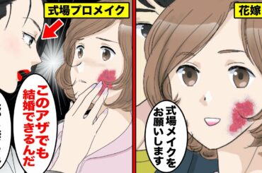 【漫画】結婚式でメイクをお願いしたら「この顔で笑われても私のせいじゃないからw」プロメイク師にアザをバカにされた女の末路・・・