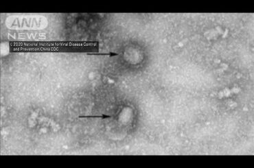 きのう帰国の3人　新型コロナウイルス感染確認(20/01/30)