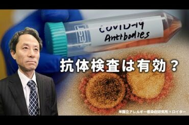 日経編集委員の新型コロナ解説②「抗体検査は有効か」
