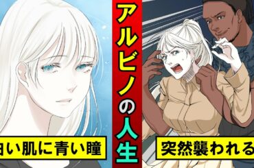 アルビノで生まれるとどうなるのか？2万分の1の確率