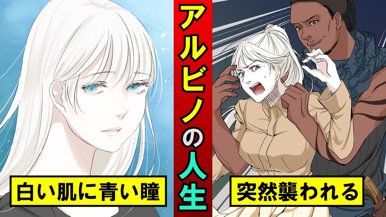 アルビノで生まれるとどうなるのか?2万分の1の確率 アルビノで生まれるとどうなるのか?2万分の1の確率
