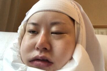 2週間断食＆顔面マヒ…輪郭整形のダウンタイム全部見せます