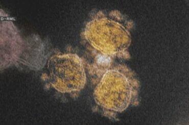 退院した旭川の男性　症状語る【HTBニュース】