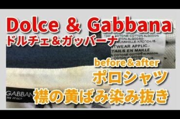 襟黄ばみ 染み抜き クリーニング 【 Dolce & Gabbana （ ドルチェ＆ガッバーナ ） スポーツシャツ 染み抜き 】 宅配クリーニング せんたく屋太郎