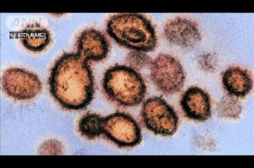 東京で新たに68人感染　一日の感染者数の最多を更新(20/03/30)