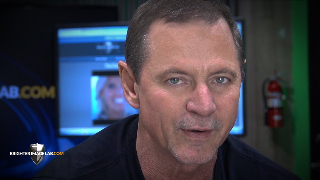 How Fluorosis Stops New Mother from Smiling… From Brighter Image Lab How Fluorosis Stops New Mother from Smiling... From Brighter Image Lab