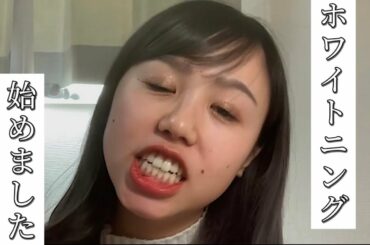 ホワイトニング始めました。