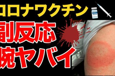 【超怖い!】コロナワクチン接種後の副反応で新たな症状|死亡者データ