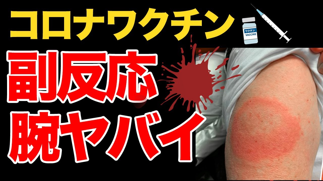 【超怖い!】コロナワクチン接種後の副反応で新たな症状|死亡者データ