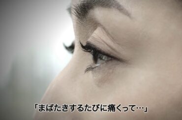 デコボコアイは、眼科医へCM