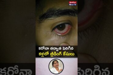 Eye Bleeds After COVID: Cause for Concern or Not? l Dr. Sree Lakshmi Nimmagadda #shorts@MedPlusONETV