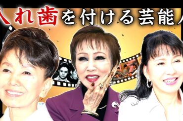 実は義歯・入れ歯を付けている芸能人・有名人２１選【偽物の歯】