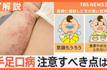 手足口病が全国で“警報レベル” アルコール消毒は効果なし？食事や水分は？子どもの異変をチェック【Nスタ解説】｜TBS NEWS DIG