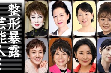 多重整形を専門家に暴露された女性芸能人・有名人１９選【※激変した姿】