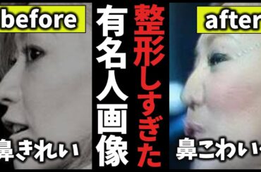 【有益2ch】整形しすぎて顔が変わってしまった芸能人と末路教えて【ガルちゃん】