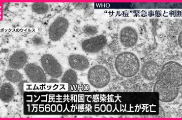 【エムポックス（サル痘）】WHOが緊急事態と判断