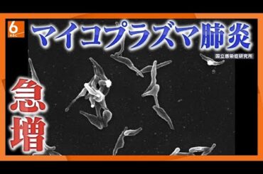 【8年ぶり大流行中】なぜ？「歩く肺炎」マイコプラズマ肺炎　数日咳止まらず発熱に懈怠感　ポストコロナで「モグラたたきのように」病原体発生の可能性も