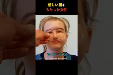 新しい顔をもらった女性