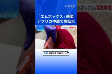 「エムポックス」感染がアフリカ中部で急拡大　WHOが1年ぶりの緊急事態宣言　感染1万4000人以上・524人死亡｜TBS NEWS DIG #shorts