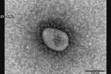 新型コロナ感染者数前週を下回る　手足口病の感染者数は上回り県は基本的な感染対策呼びかけ
