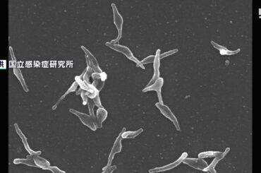 「オリンピック肺炎」とも言われ4の倍数の年に流行　背景に新型コロナが…「マイコプラズマ肺炎」患者が増加=静岡