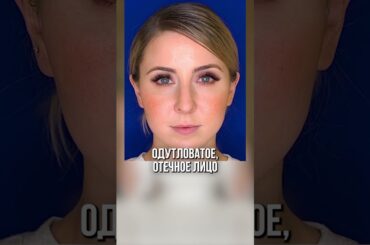 Откажись от ЭТОГО! Как вылечить прыщи и акне? #уходзалицом #акне #прыщи
