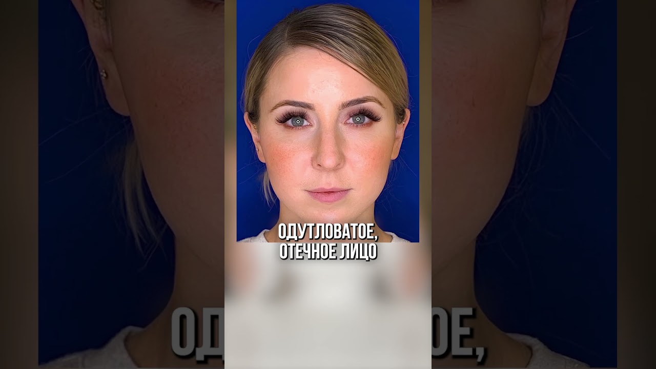 Откажись от ЭТОГО! Как вылечить прыщи и акне? #уходзалицом #акне #прыщи Откажись от ЭТОГО! Как вылечить прыщи и акне? #уходзалицом #акне #прыщи