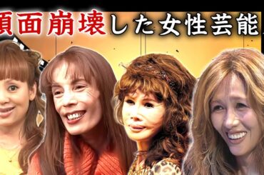 整形のしすぎで顔面崩壊した女性芸能人・有名人３０選