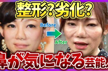 【芸能人の鼻】整形、肥大化、劣化…鼻に違和感を感じる芸能人！【ガールズちゃんねる】