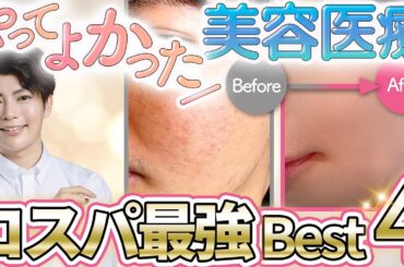 【肌管理Best4】やってよかった！美肌になれるエイジング美容医療・施術を紹介【シミ・シワ・ニキビ跡・たるみ】