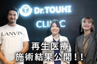 【再生医療】6ヶ月間PRP療法を施術した結果...