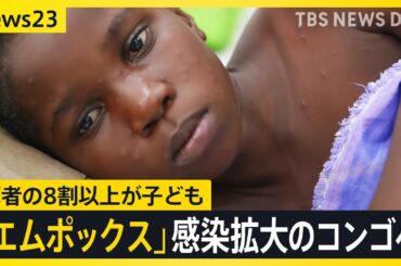 新たな変異株は死者の8割以上が子ども　WHOが緊急事態を宣言の「エムポックス」震源地のコンゴ民主では日本のワクチンに期待【news23】｜TBS NEWS DIG