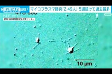 【速報】マイコプラズマ肺炎　全国の患者数「2.49人」　5週連続で過去最多を更新(2024年11月5日)