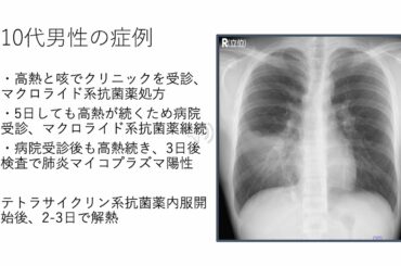 市民公開講座「流行りの感染症」”2024年流行　肺炎マイコプラズマ感染症”（医師）