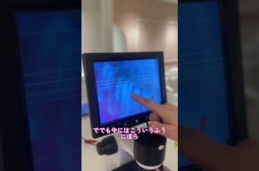 60歳美容家の毛細血管チェック！