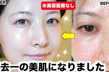【冬スキンケア】毛穴も肌荒れもひどかった私が圧倒的美肌を手に入れたスキンケアルーティン【乾燥肌】
