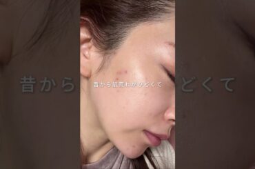 美肌オタクおすすめ❤ニキビや肌荒れを改善して垢抜けたい！ #shorts #美容 #スキンケア