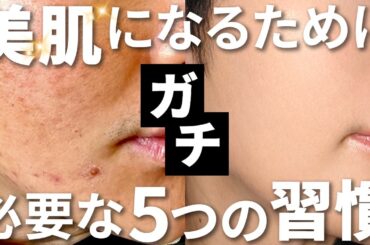 【一生続けたい習慣】元汚肌が美肌になるために実施しているアンチエイジング習慣5つ【毛穴、ニキビ、シミ、シワ】