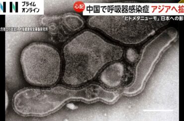 中国で呼吸器感染症「ヒトメタニューモウイルス」増加…日本でも感染者　延べ90億人移動の春節に感染拡大か