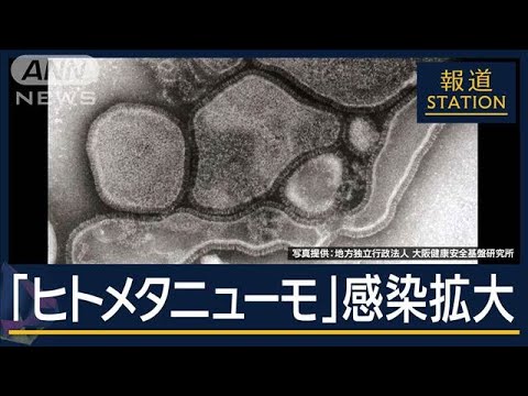 症状は?日本で流行の可能性は?中国で急増『ヒトメタニューモ』忽那賢志教授に聞く【報道ステーション】(2025年1月9日) 症状は?日本で流行の可能性は?中国で急増『ヒトメタニューモ』忽那賢志教授に聞く【報道ステーション】(2025年1月9日)
