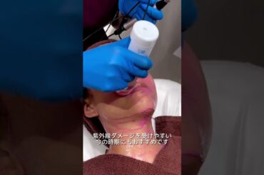 美肌には組み合わせ施術がオススメです！#美容医療 #ニキビ跡#クレーター #卵肌#表参道メディカルクリニック #美容皮膚科