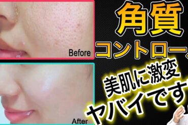 美肌確定【角質コントロール】って自宅で簡単にできるからやってみて♪