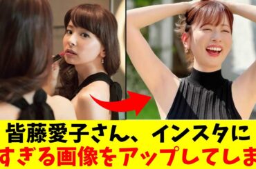 皆藤愛子さん、どうしたの？【フジテレビ・女子アナ】