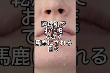 これで私も可愛くなれる #乾燥肌対策 #化粧品 #美肌 #保湿力