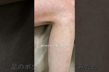 BDショットってどうなの？って思ってる人いるかもだからガチレビューしてみた✌🏻 #美容液 #スキンケア #毛穴 #ニードルショット #リードルショット #BDショット #垢抜け #韓国コスメ #pr