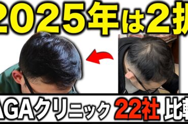 【2025年版】AGAクリニックおすすめ解説【個人輸入治療の終了】