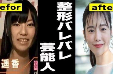 【有益2ch】整形バレバレ芸能人【ガルちゃん芸能人】