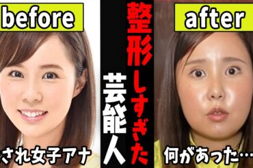 この人も！？整形で顔が変わってしまった芸能人…【ガルちゃん芸能・有益2ch】