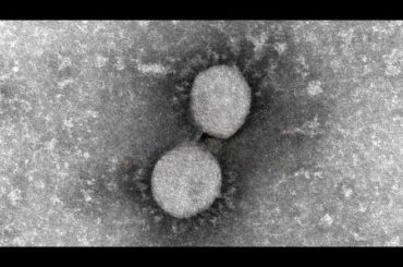 新型コロナ 熊本県内の感染者数が5週連続増加 全国平均2倍以上に
