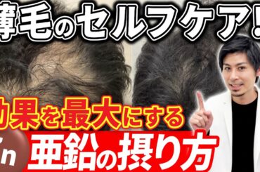 亜鉛を最大限に活かす方法って？プロの医師が解説します！【AGA/薄毛改善/ハゲ】